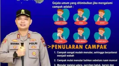Campak Berpotensi Jadi Wabah, Polres Sumenep Minta Warga Tingkatkan Kewaspadaan
