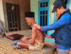 Kasus Kusta di Sumenep Turun Tajam, Kini Tinggal 150 Penderita